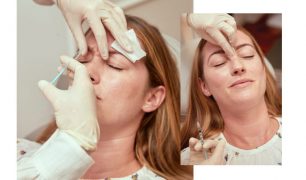 M2woman - The Changing Face of Botox